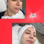 خدمات تخصصی پوست  غریبانی (بل اسکین کر)