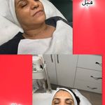 خدمات تخصصی پوست  غریبانی (بل اسکین کر)