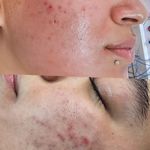 خدمات پاکسازی پوست کامرانی