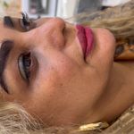 کلینیک تخصصی ژل و بوتاکس مرضیه آقابابایی