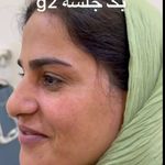 کلینیک تخصصی ژل و بوتاکس مرضیه آقابابایی