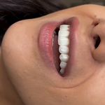 دندانپزشکی الی دنت ‌دیجیتال و اقساطی