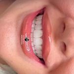 دندانپزشکی الی دنت