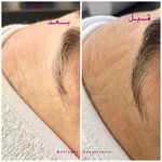 سالن زیبایی مهلقا