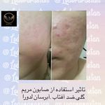 فروش محصولات آرایشی و بهداشتی LDORA