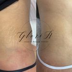 کلینیک زیبایی گلوریا