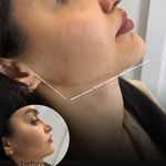 مرکز لیزر و کلینیک زیبایی پریفا