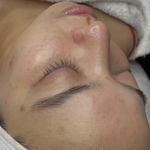 پاکسازی پوست و مو مهسام