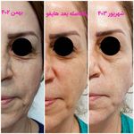کلینیک لیزر پوست مو و زیبایی رینا