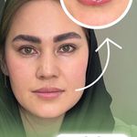 کلینیک تخصصی لیزر پوست مو مه سیما