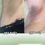 کلینیک تخصصی لیزر پوست مو مه سیما
