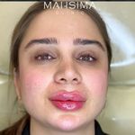 کلینیک تخصصی لیزر پوست مو مه سیما