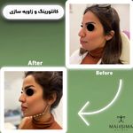 کلینیک تخصصی لیزر پوست مو مه سیما