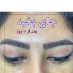 کلینیک تخصصی لیزر پوست مو مه سیما