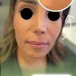 کلینیک تخصصی لیزر پوست مو مه سیما