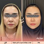 مرکز پزشکی و زیبایی میروژ سنتر