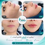 کلینیک لیزر و زیبایی لیلیا