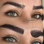 میکروبلیدینگ و شیدینگ لب