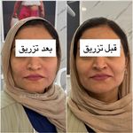 کلینیک زیبایی و لیزر دکتر آزاده اسماعیلی