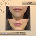 مطب پوست مو زیبایی فردوس شرق