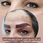 مرکز آرایش دائم وریموو وپوست گندم فلاحی