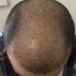 کلینیک کاشت مو سان