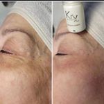 فیشال تخصصی رها فکری