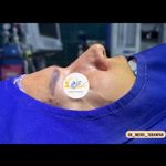 جراحی بینی و صورت دکتر مهدی تابان فر