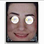 جراحی بینی و صورت دکتر مهدی تابان فر