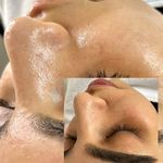 کلینیک فیشال و ماساژ سارن اسکین سارا