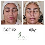 خدمات پوست ونوس