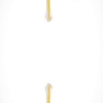 مرکز لاغری و پاکسازی پوست مانیا