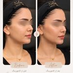 مطب زیبایی دکتر نلسا