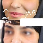 کلینیک ژل بوتاکس لیزر فیل بیوتی