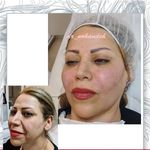 مرکز زیبایی و لیزر دکتر مریم نوکنده