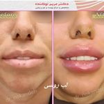 مرکز زیبایی و لیزر دکتر مریم نوکنده