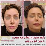 مرکز زیبایی و لیزر دکتر مریم نوکنده