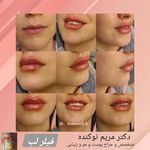 مرکز زیبایی و لیزر دکتر مریم نوکنده
