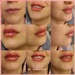 مرکز زیبایی و لیزر دکتر مریم نوکنده