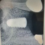 دندانپزشکی ایمپلنت و کلیه خدمات
