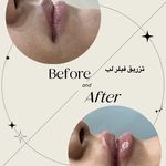 کلینیک زیبایی لاغری لیزر دانا