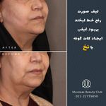 کلینیک پوست و مو موتاکس ملکی