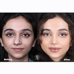 دکتر بهروز جلالی (جراحی بینی لیفت صورت)