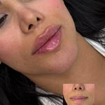 کلینیک پوست وزیبایی ومرکز تخصصی فیلربادی