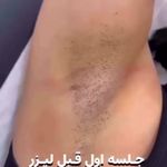 مرکز زیبایی وخدمات لیزر و فیشیال تراپی