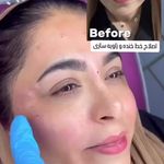 مرکز زیبایی وخدمات لیزر و فیشیال تراپی