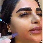 مرکز لیزر و فیشیال سلین( الکس شاتی)