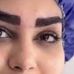 کلینیک زیبایی الماس کاملا اقساطی