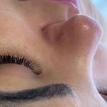 خدمات تخصصی پاکسازی پوست صورت و بدن