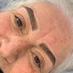 ریموو شیدینگ میکروبلیدینگ